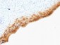 Anti-Filaggrin Antibody